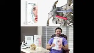 Livro ZIGOMA 2.0 - A Nova Era dos Implantes Zigomáticos