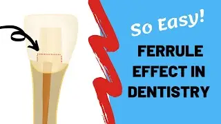 Ferrule effect in dentistry simplified | @Dr Teeth
