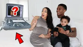 YOU'LL NEVER GUESS WHO OUR BABY BOY LOOKS LIKE! *4D Ultrasound*