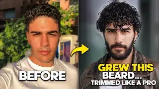 This Happened When I Grew My Beard… How to Trim It Like a Pro