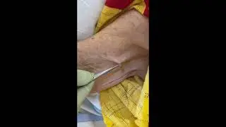How To Remove a Tick