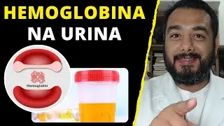 What does positive hemoglobin in the urine (hemoglobinuria) mean in a type 1 urine test?