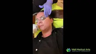 Laser Hair Reduction at Well Medical Arts