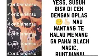 KASUS AMY BMJ DAN TUDUHAN TE PASANG SUSUK, BENAR KAH ADA SUSUK!!?? DAN BISA KAH DI CEK??!