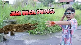 CHILD'S FINGERS EATEN BY A CROCODILE!!!