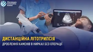 Дроблення каменів в нирках