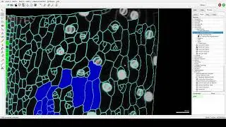 Tutorial Video S4 Cell classification with SVM