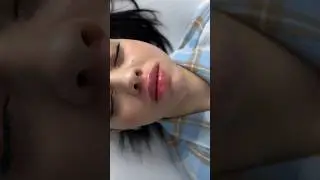 Губы увеличение до/после 