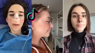 Nose Job Check 👃🏼✔👀✨TikTok Compilation✨