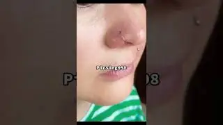 Интим проколы