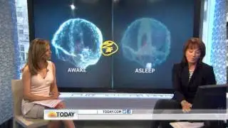 What your brain looks like on prescription meds