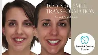 Smile makeovers at berwick dental studio