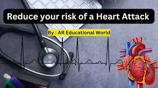 Risk of Heart Attack