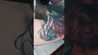 Процесс удаления тату. Неодимовый лазер