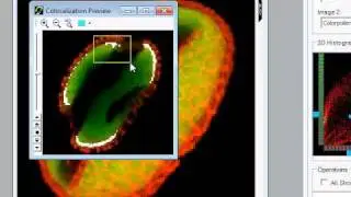 AutoQuant Colocalization tutorial