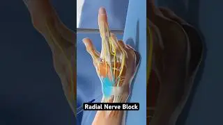 Nerve blocks explained (3D Animation)