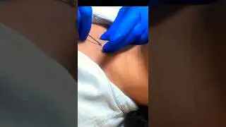 Installation of subcutaneous microdermal. @pirsingalmata