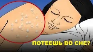 Потею во сне, причины потения детей и взрослых во сне ночью