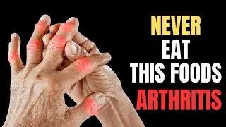 🔥7 WORST Foods for Arthritis & Joint Pain | Arthritis Foods to Avoid |