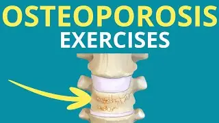 5 Exercises for Osteoporosis