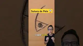 Rotação de Retalho 😱