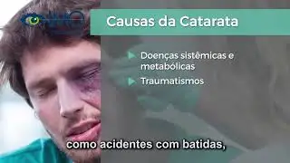 IMO - Catarata - Causas