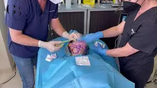 Sesión de Tratamiento Facetite para eliminar la flacidez del rostro