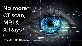 Googles AI to predict heart disease using eye scans? | AI revolution in healthcare