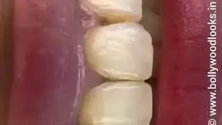 How is a Smile Designed