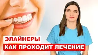 How does treatment with aligners work?