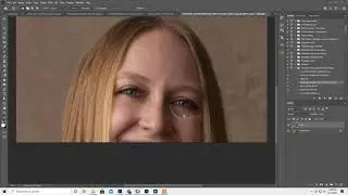 The NEW content aware fill for forehead veins with Photoshop, patch tool, under eye area
