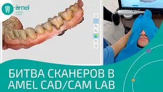 Битва сканеров в Bauers CAD/CAM Lab | Bauers Dental Store