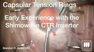 Using CTR's and Early Experience with the Shimowake CTR