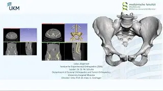 3D Slicer Tutorial: Pelvic Bone Segmentation
