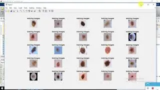 Deep learning based skin lesion segmentation - own data , convolution neural network  - own data