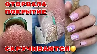Скрученные ногти 😐 Оторванное покрытие 💅 Маникюр на квадрат