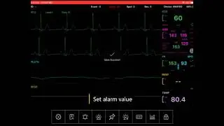 AM 6100 Veterinary Monitor App Operation