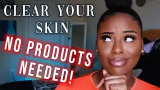 HOW TO: CLEAR Your Skin WITHOUT Using ANY PRODUCTS FAST!!! | For Acne Prone Skin|| LexsaMarie