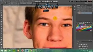 Sivilce Yok Etme,Yüz Temizleme,Hd,Sesli,Cs6