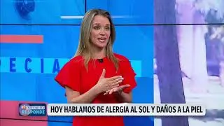 El especialista responde: Alergia al sol y daños a la piel | 24 Horas TVN Chile