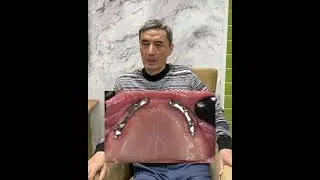 Отзыв пациента клиники Aray Dent