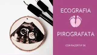 Pirografia di una ecografia su legno