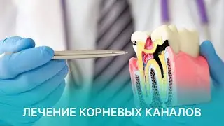 Лечение корневых каналов: больно или нет?