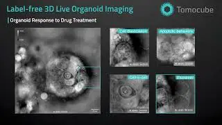 Organoid Drug Treatment