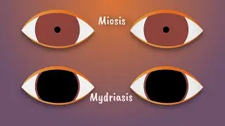 🔍 Pupil Dilation vs. Pupil Constriction: Causes & Clinical Clues!