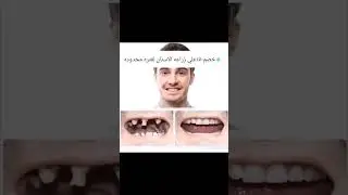 شاهد الفيديو واعمل لايك لو تكرمت
