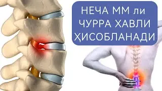 Қай бири хавфли чурра? ГАРАНТИЯ БЕРАСИЗМИ? #grija  #akromkineziolog #грижа #kineziologiyatashkent