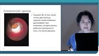 Левченко Ю.С. - Индивидуализация ОКЛ и ее роль в комплаенсе врача-ортокератолога