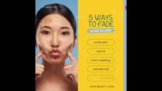 5 ways to fade Acne Scars  