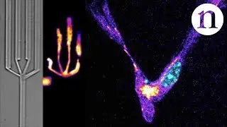 Immune cells tackle a human obstacle course